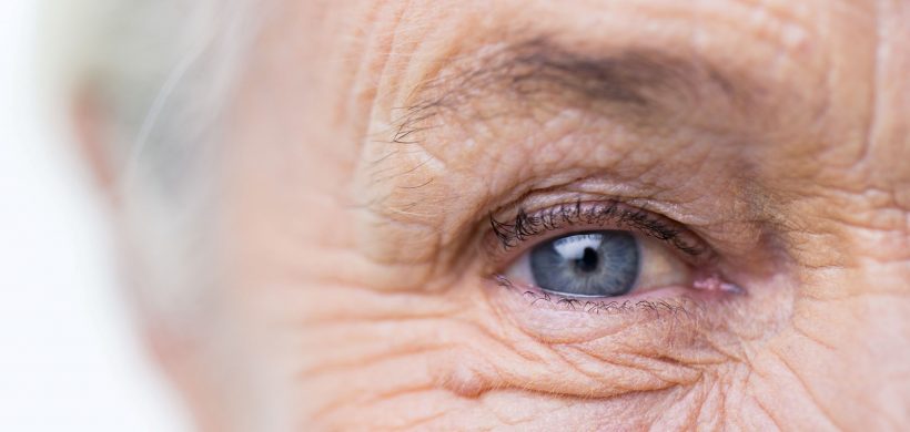 Cognición y visión en alzhéimer